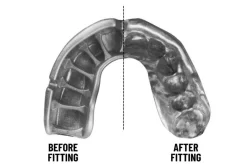 Protège-dents Simple, Thermoformable - OPRO X UFC Self-fit, OPRO -Boutique de boxe protege dents simple thermoformable self fit v2 opro 3