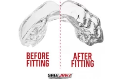 Protège-dents Simple, Thermoformable - Translucide, Safe Jawz -Boutique de boxe protege dents simple thermoformable translucide safe jaws 3
